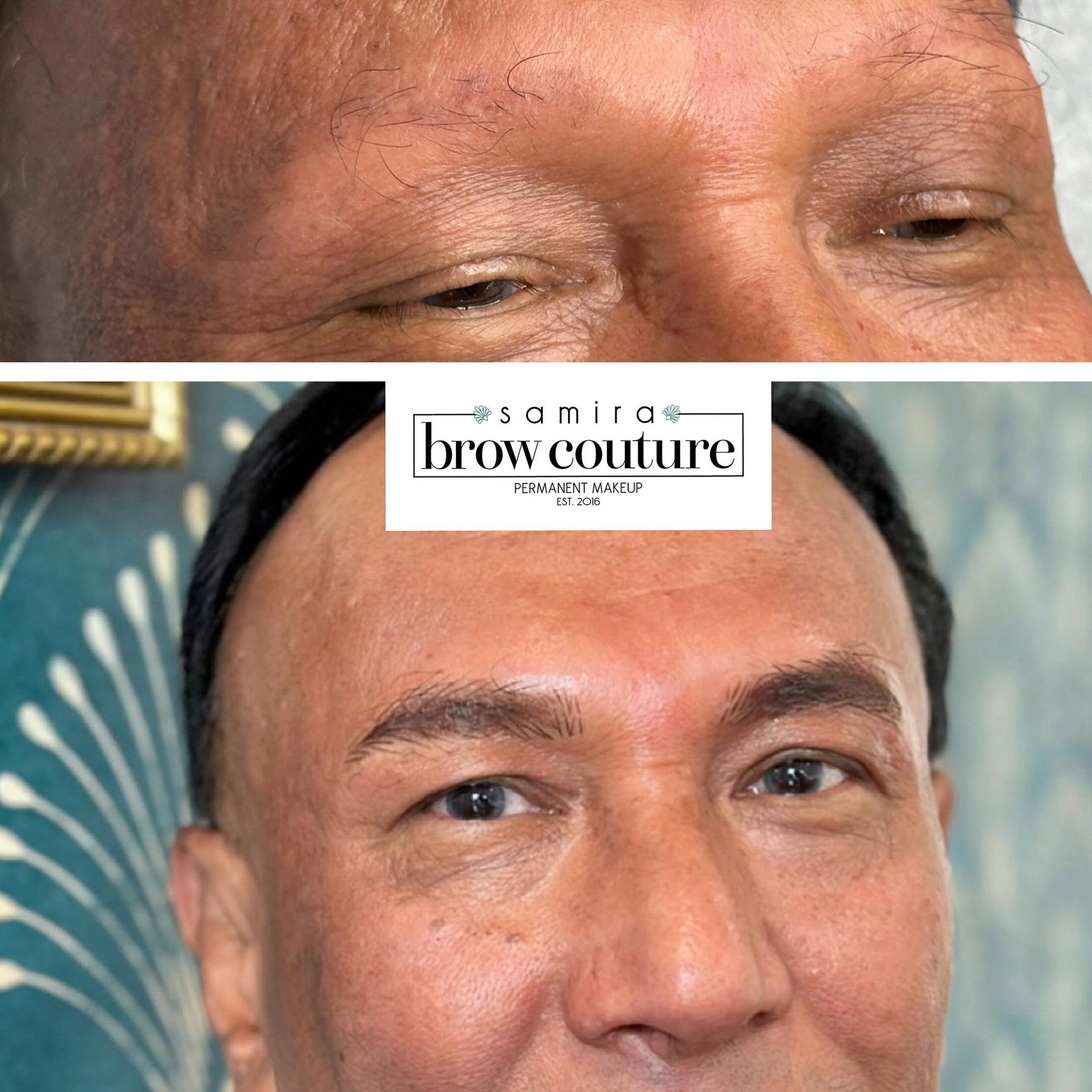 He has alopecia and lost his brows over the past 3 years because in his words &ldquo;his business caused him a lot of stress and his daughters encouraged him to get his brows done with me&rdquo;. At his appointment, he showed me a photo of himself fr