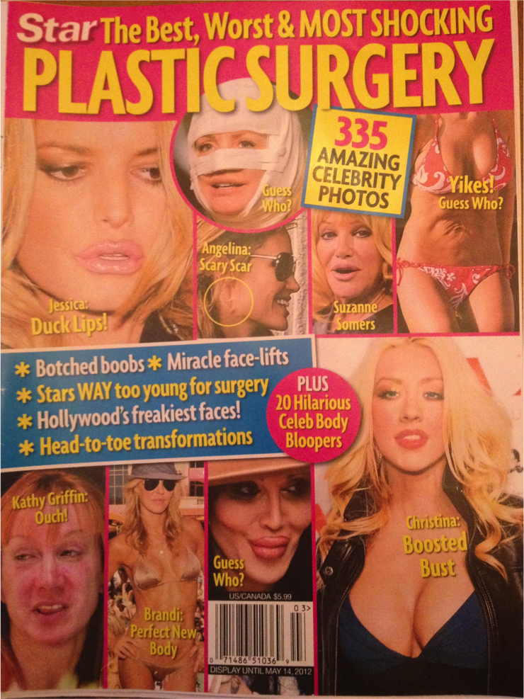 star_magazine_plastic_surgery_cover.png