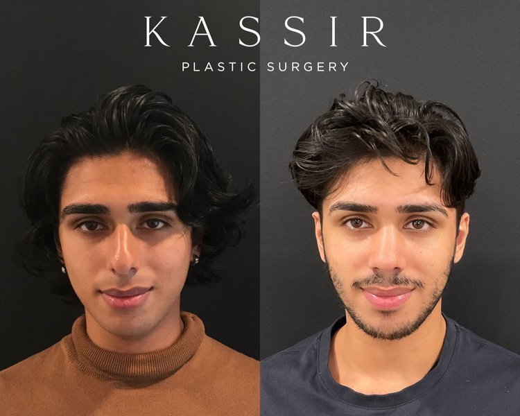 Precision in Beauty: Masterful Expertise of a Plastic Surgeon