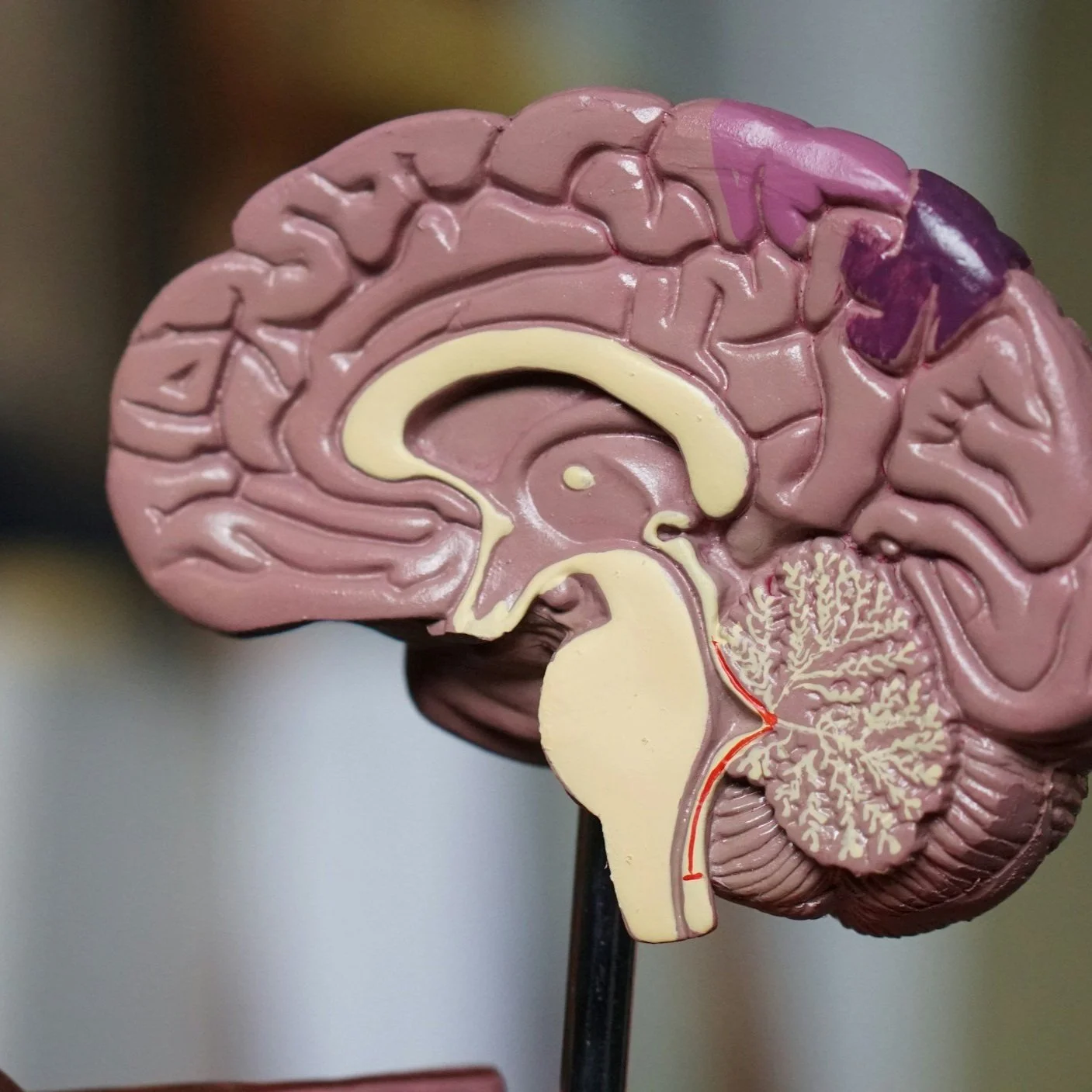 anatomical model showing a cross‑section of the human brain on a display stand