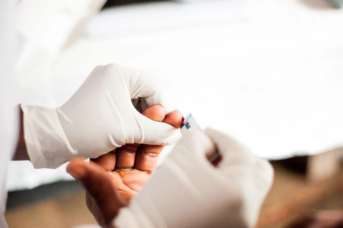 HIV Testing: Can You Trust a Negative Result?