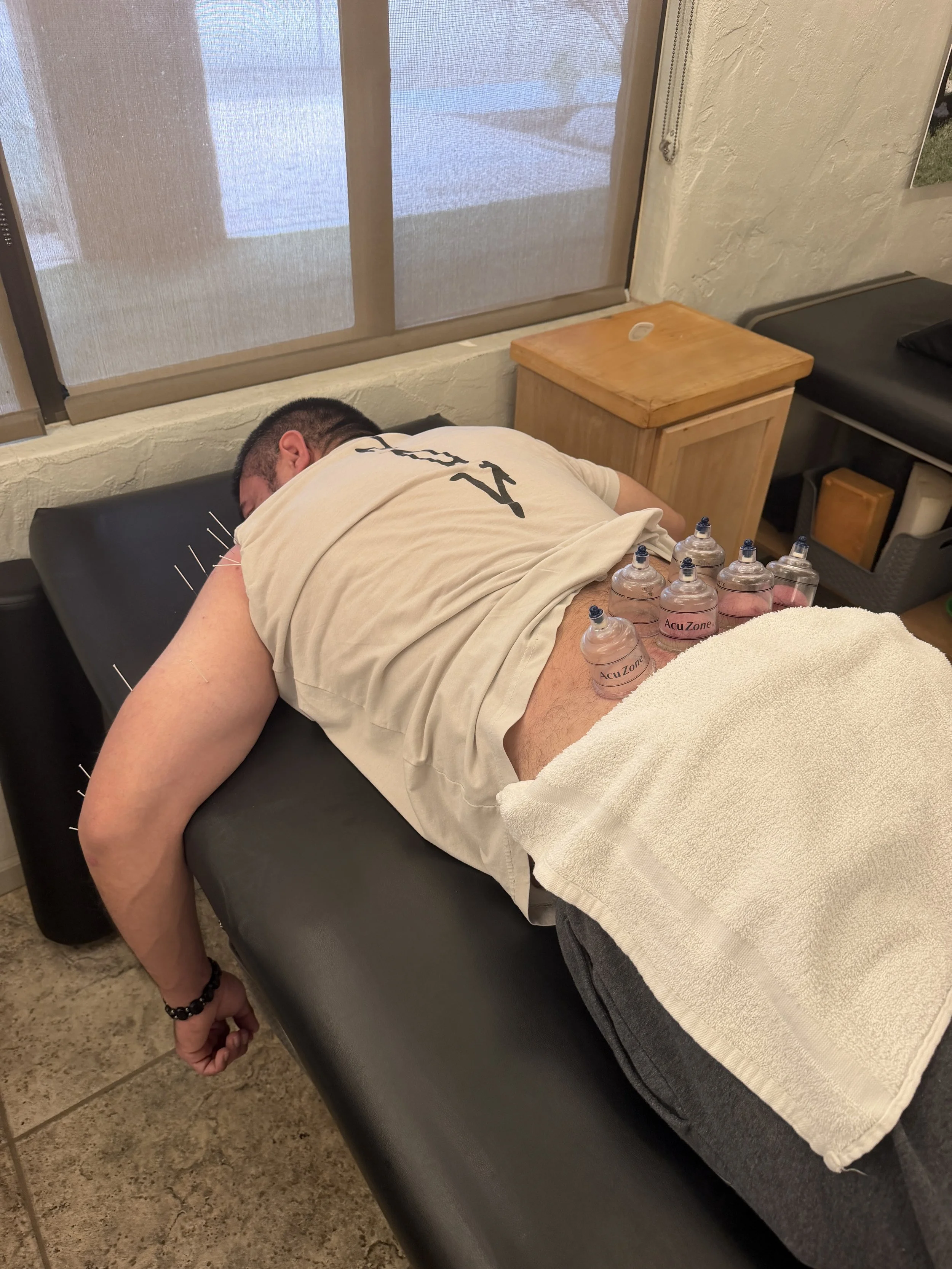 CUPPING & SCRAPING