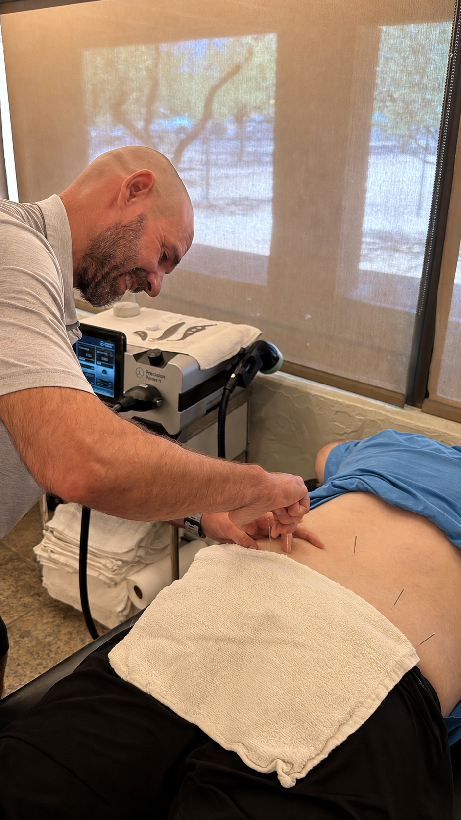 DRY NEEDLING