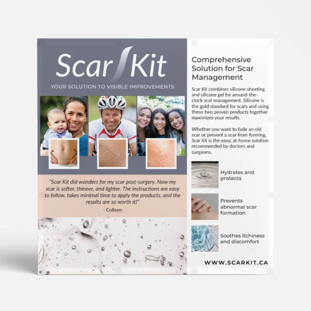 Mayfair Creative's Portfolio | Scar Kit Scar Solutions — Mayfair ...