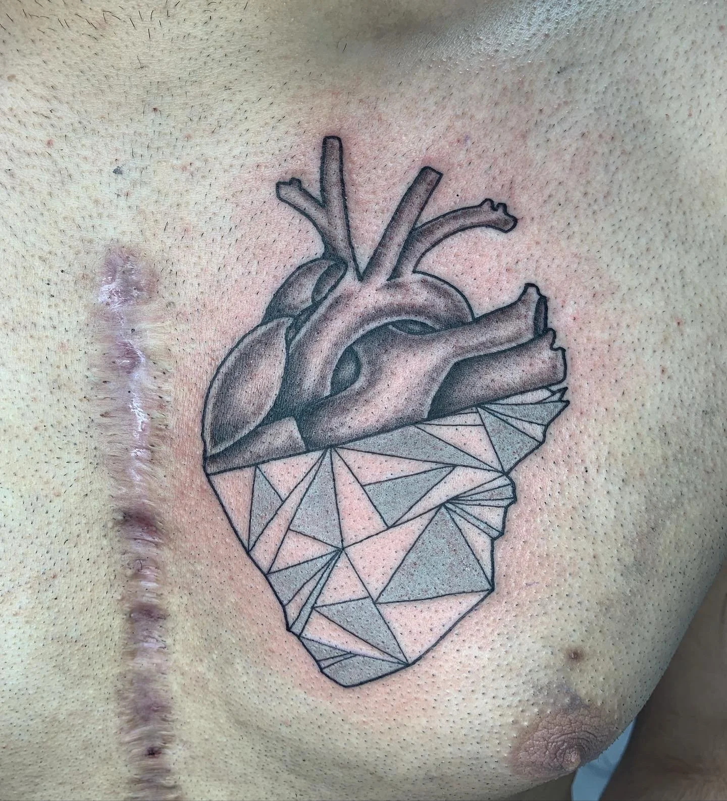 anatomical heart - bg.JPG