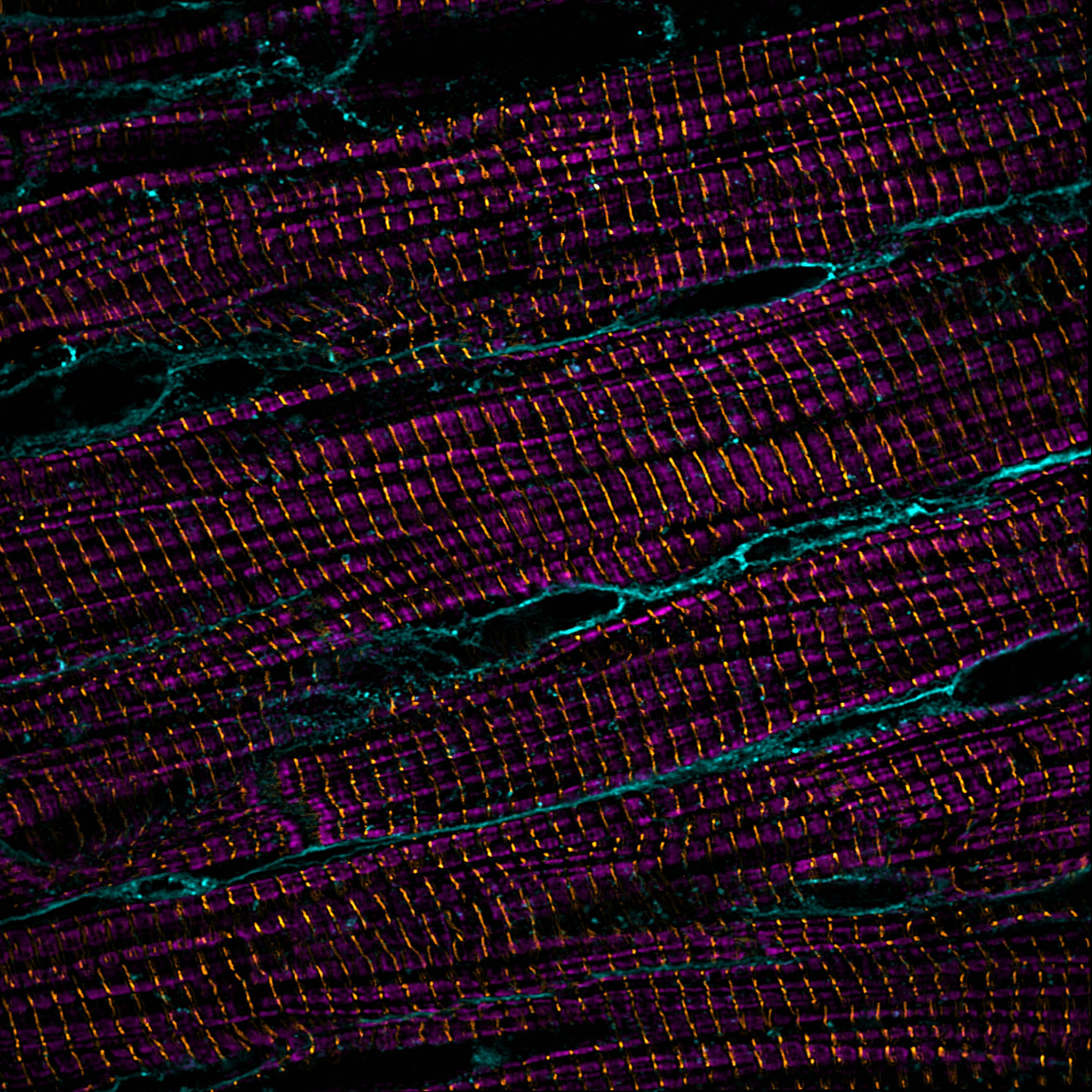 Super-resolution imaging of cardiomyoctes: sarcomere thin filaments (magenta), z-discs (yellow), cell membranes (teal)