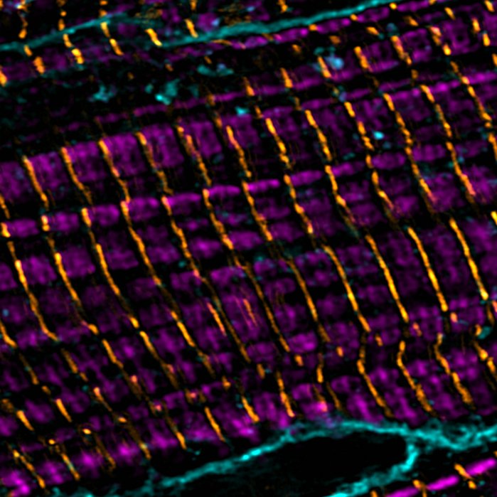 Super-resolution imaging of cardiomyoctes: sarcomere thin filaments (magenta), z-discs (yellow), cell membranes (teal)
