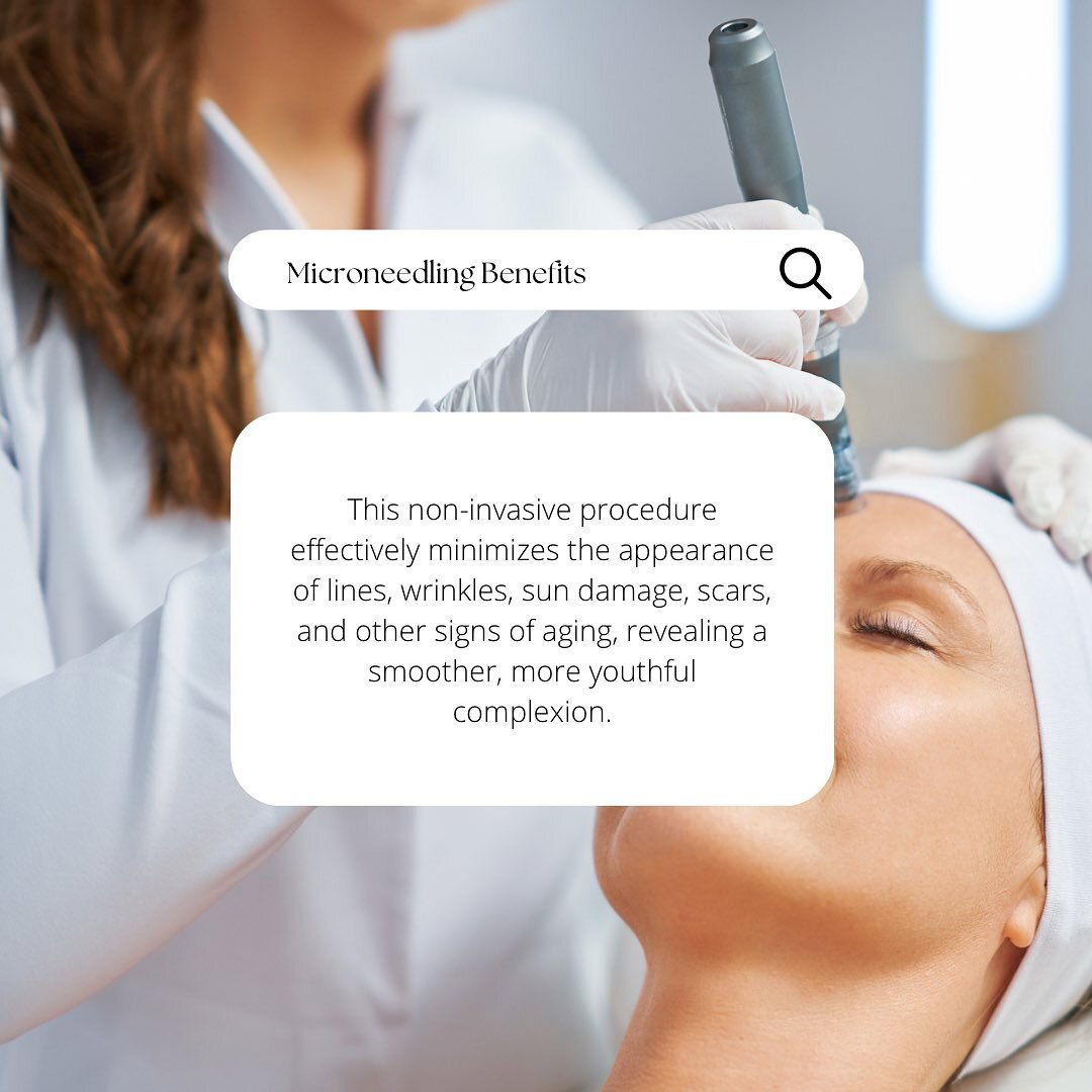 Microneedling🌿.

Transform your skin with the rejuvenating power of microneedling. Experience a radiant glow after just one treatment, with continued benefits that last for months. This non-invasive procedure effectively minimizes the appearance of 