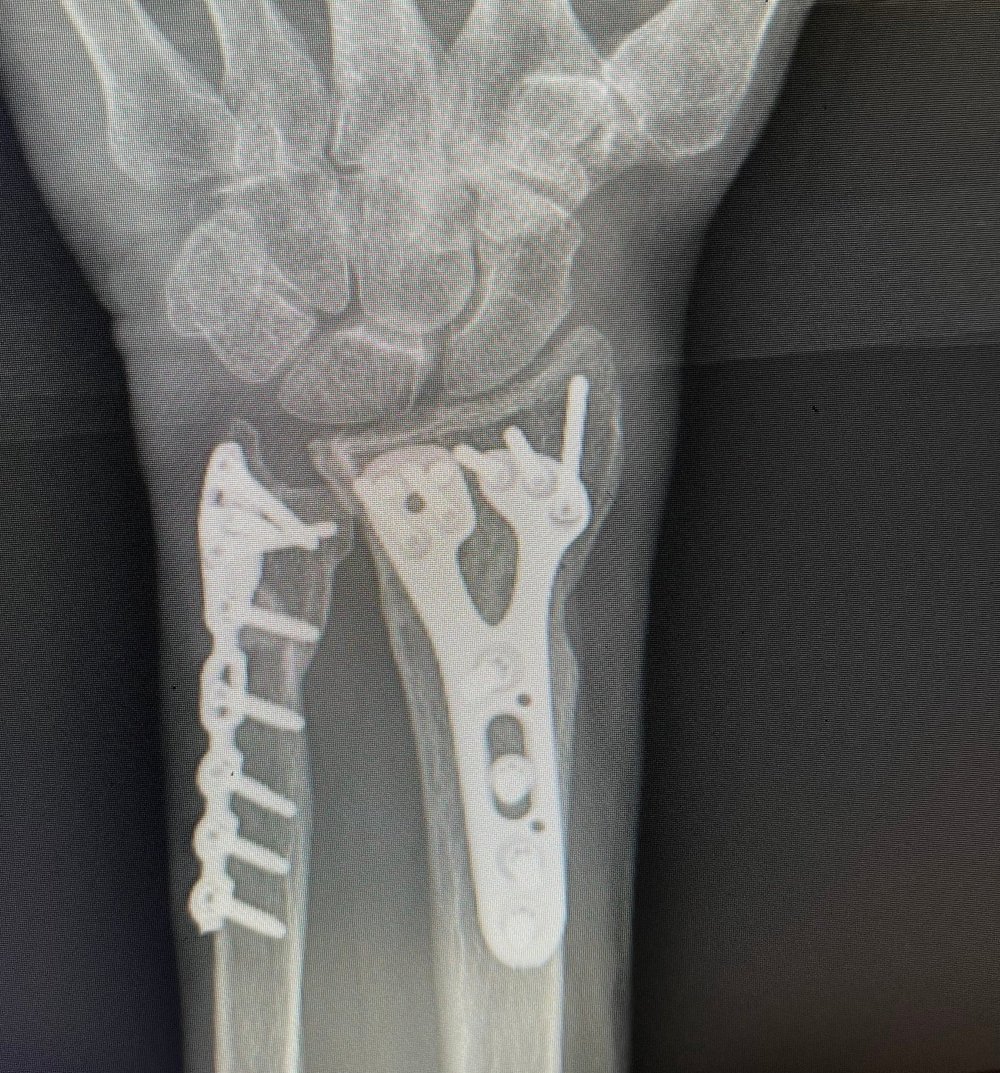 Scientific Breakthroughs in Bone Regeneration