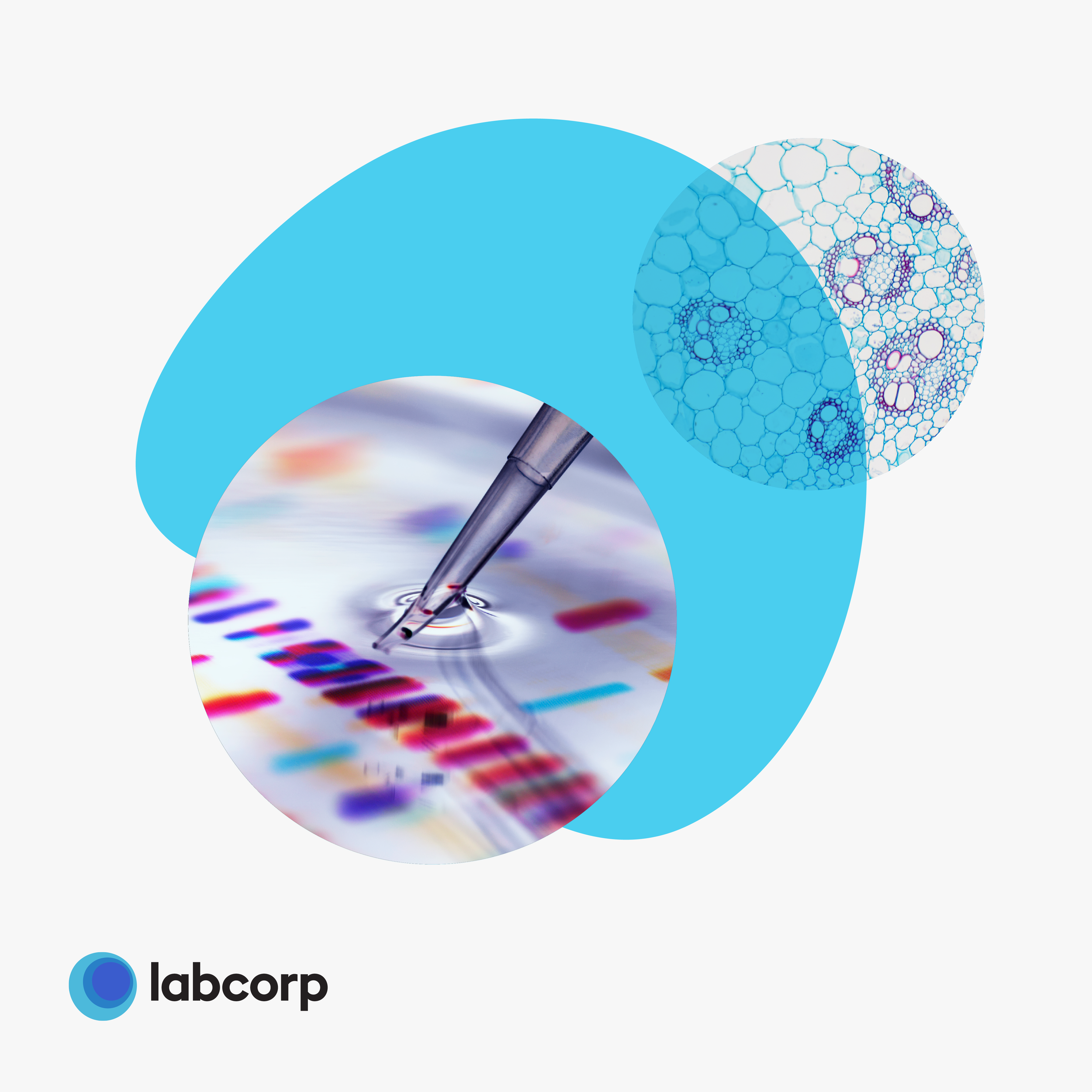 Graphic design featuring overlapping circles with images of laboratory research, including a pipette with a liquid sample, microscopic cellular images, and colorful DNA sequencing data, alongside a logo for "labcorp".