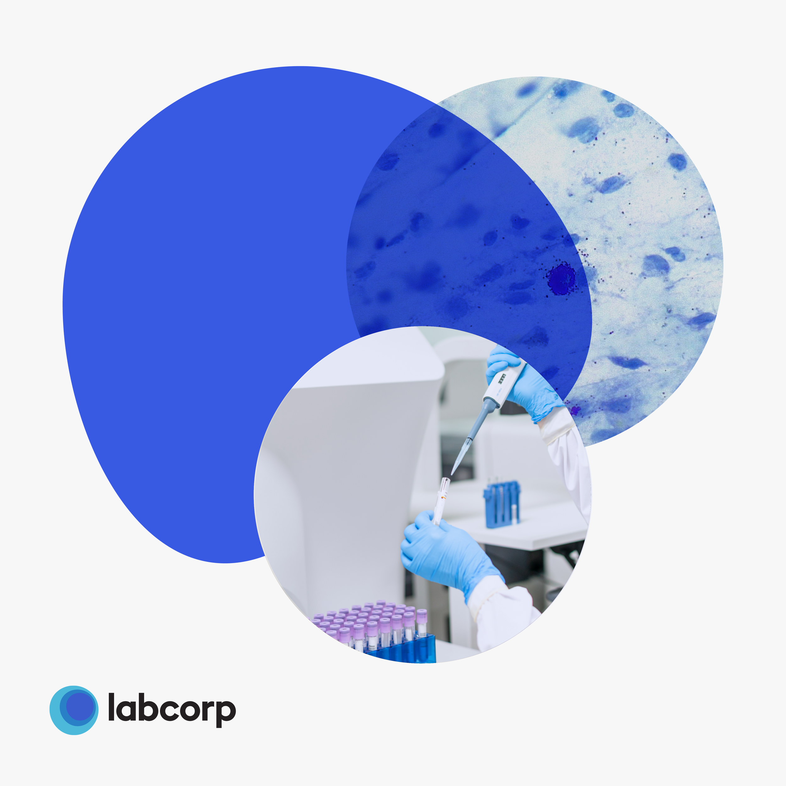 A digital collage featuring three overlapping circles with a blue, abstract pattern, and a photograph of a scientist wearing blue gloves and a lab coat, using a pipette to transfer liquid into test tubes, with the research lab's logo "labcorp" in the bottom left corner.