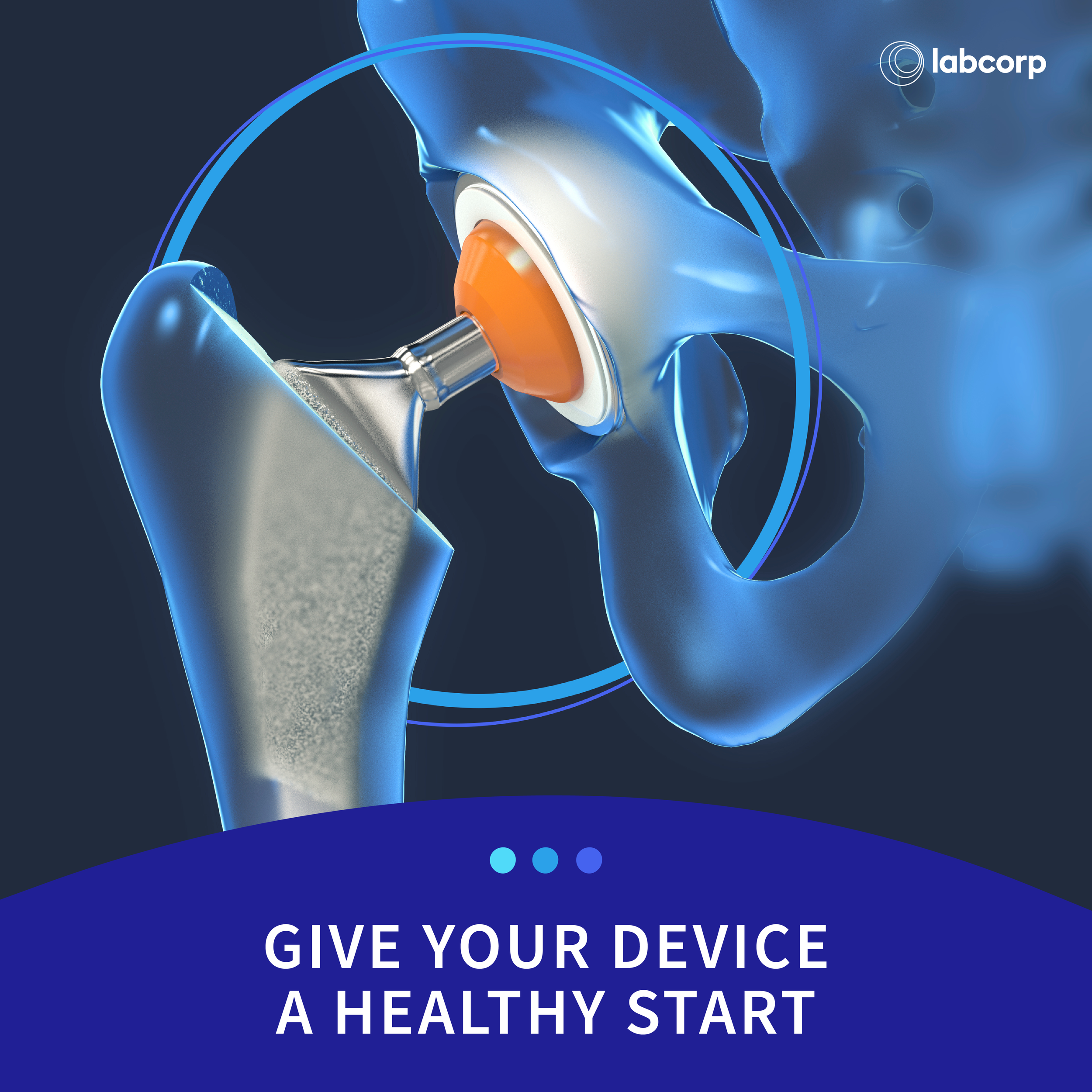 A digital illustration of a hip joint with a medical device, promoting health and device maintenance, with the text 'Give Your Device a Healthy Start' and the labcorp logo.