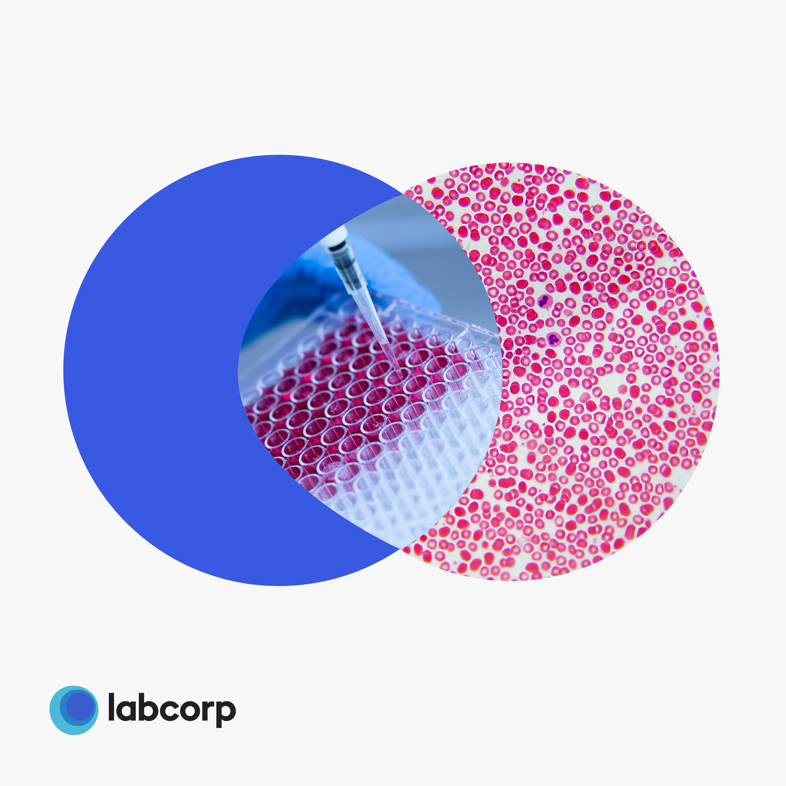 Venn diagram with overlapping circles. The left circle contains a laboratory image of red blood cells in a multi-well plate with a pipette. The right circle shows a close-up of red blood cells under a microscope. The overlapping area combines elements of both images. The bottom left corner features the Labcorp logo.