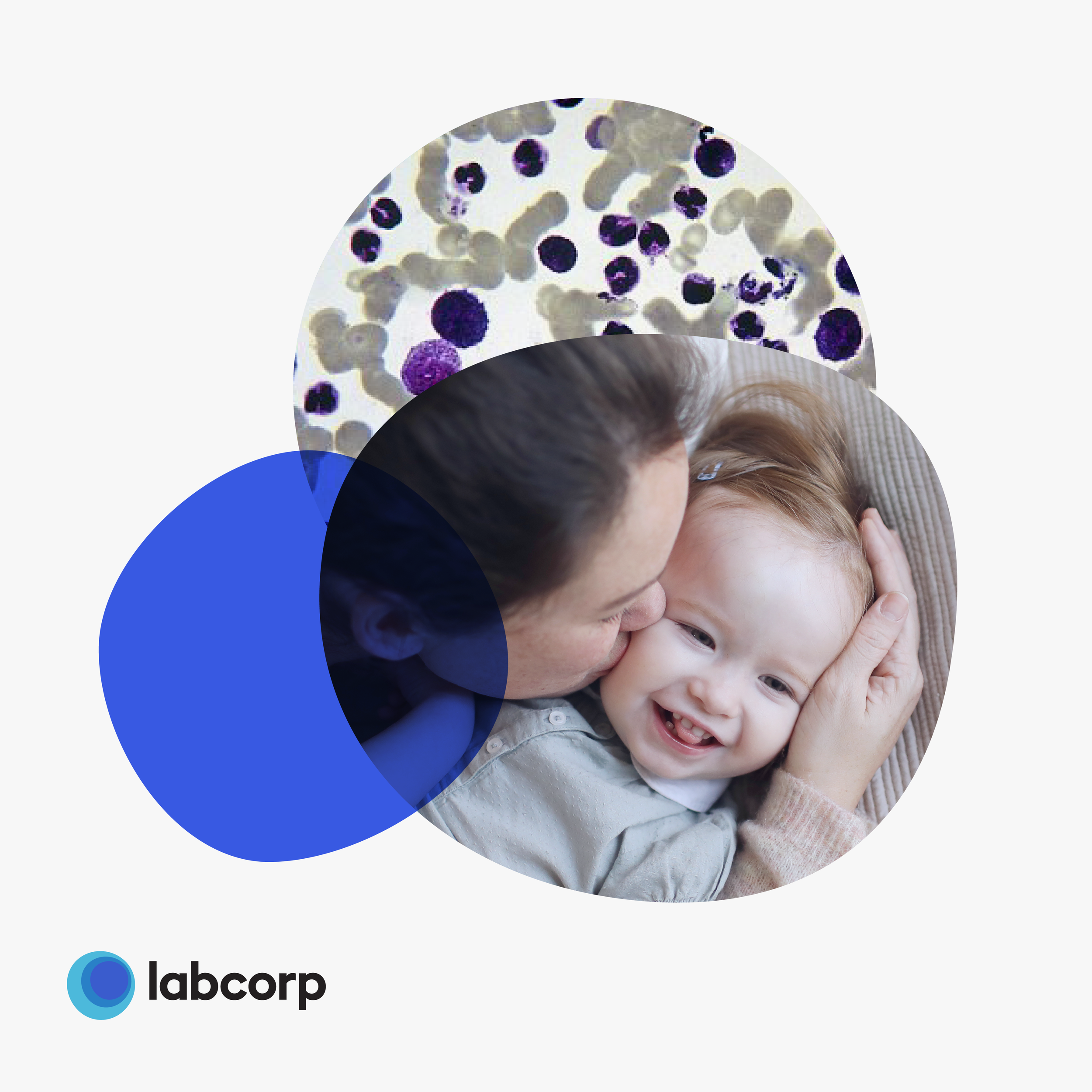 A healthcare illustration showing a close-up of a mother kissing her smiling young child on the cheek, with an overlay of microscopic cells and the Labcorp logo.