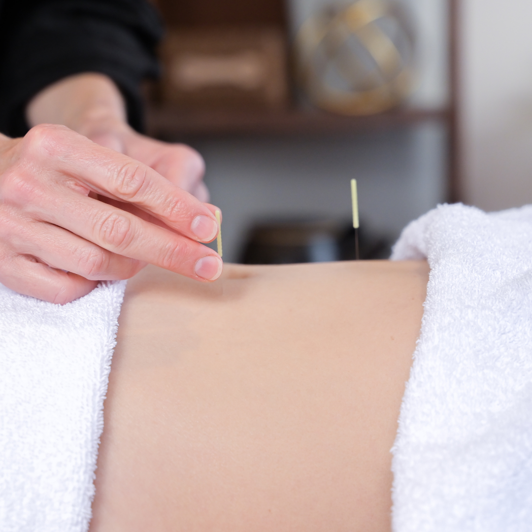 Full Acupuncture Consultation - The Melbourne Apothecary