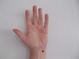 Image of left hand indicating the Shenmen pressure point