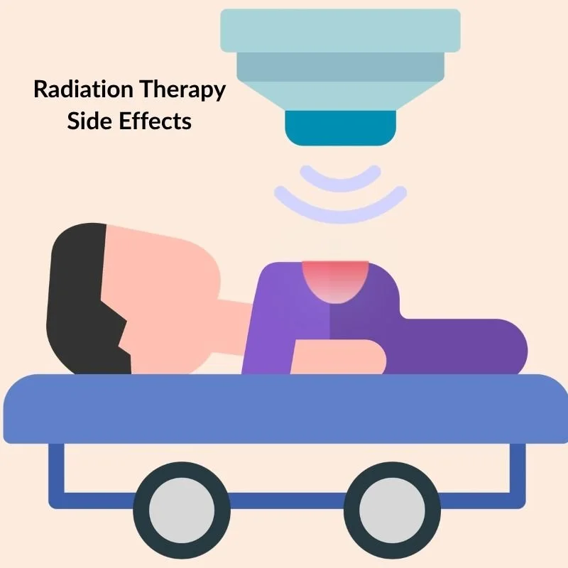 Diagram of a person getting radiation treatment on abdomen