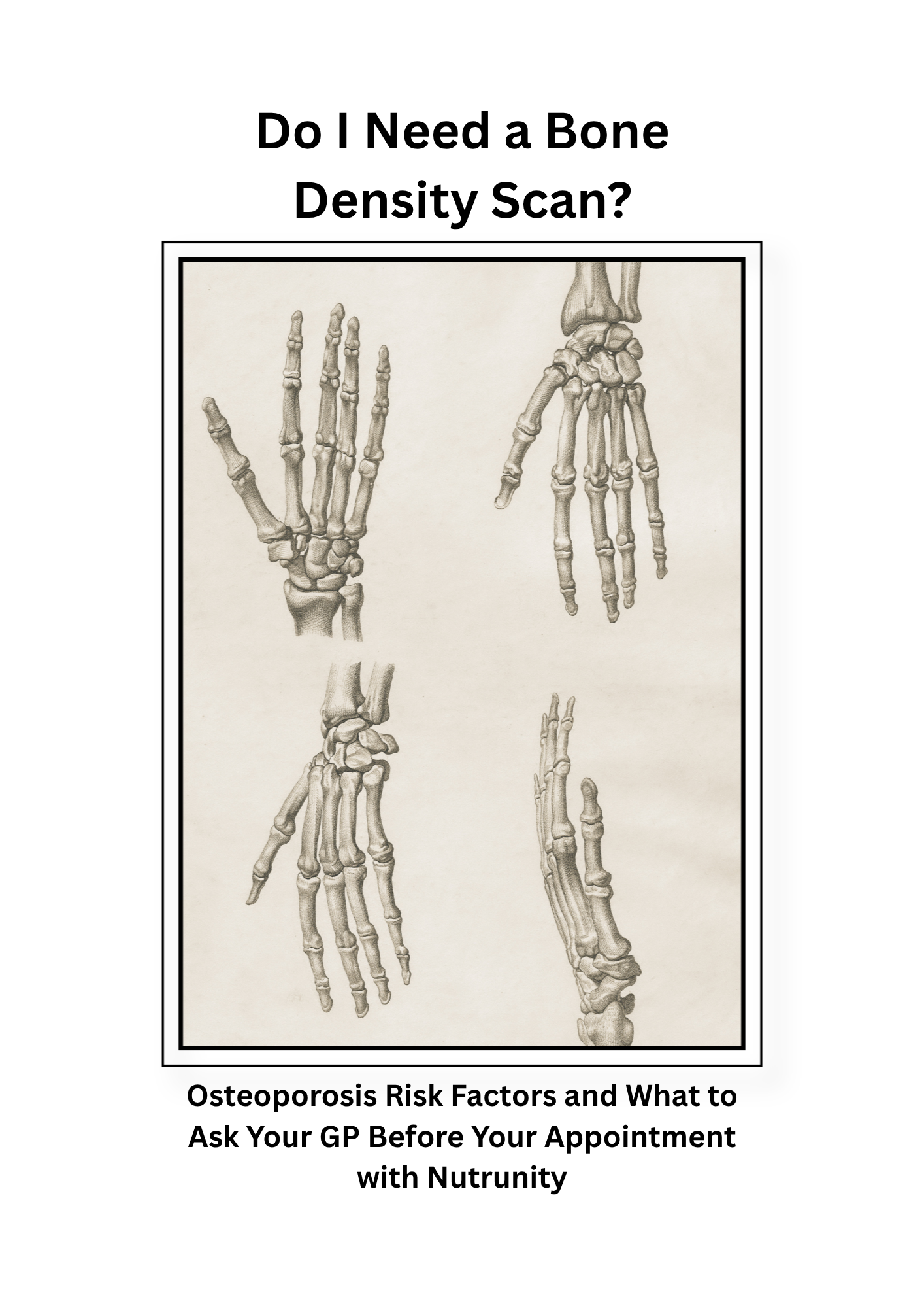 Do I Need a Bone Density Scan? Osteoporosis Risk Factors and What to Ask Your GP Before Your Appointment with 