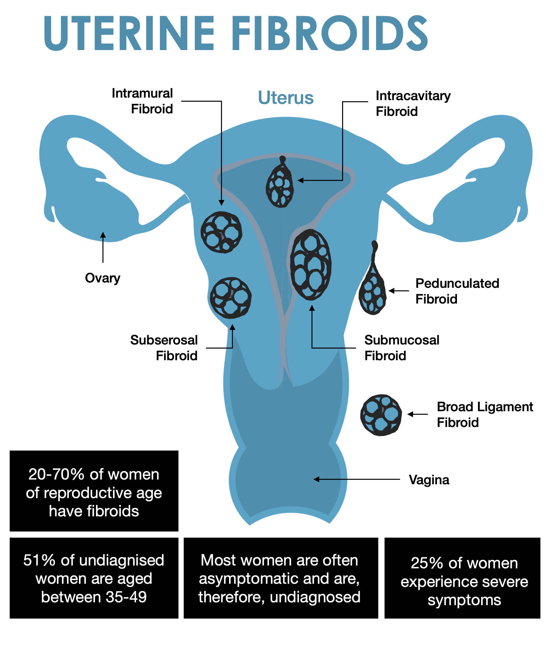 Uterine Fibroids: A Holistic Approach — Nutrunity⎪Naturopathic Clinic ...