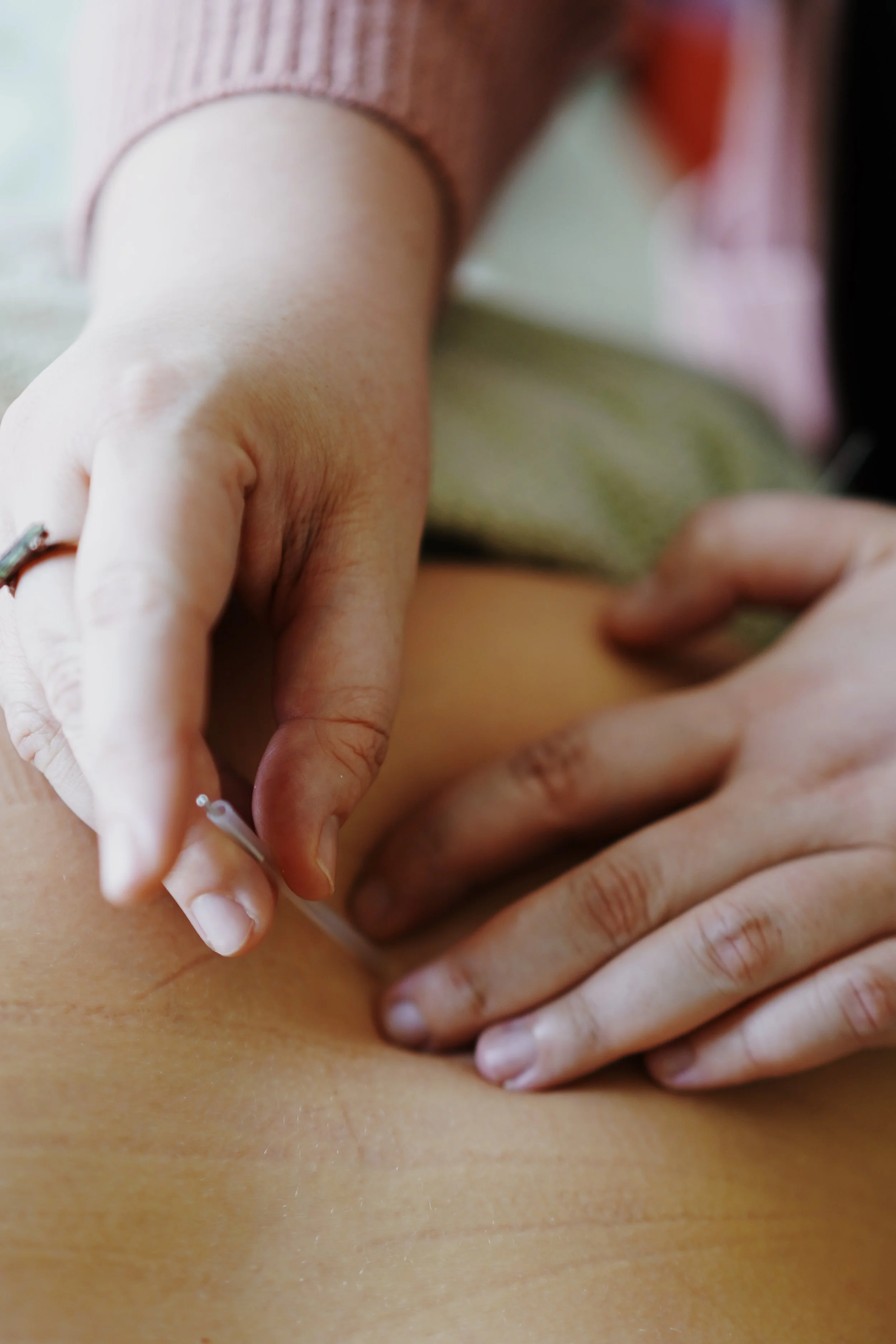 What Does Acupuncture Feel Like? (Is It Painful? What are common sensations?)