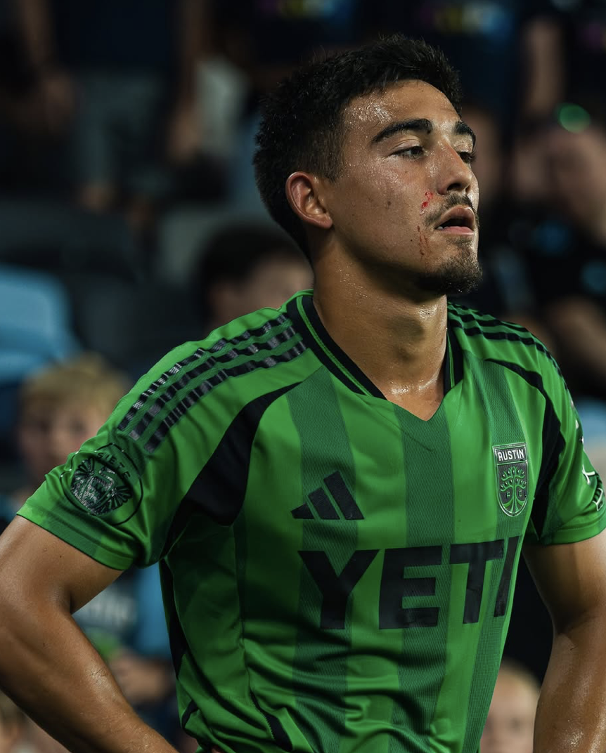 Blood, sweat, and tears. Simply Owen Wolff. (Dante Valencia)