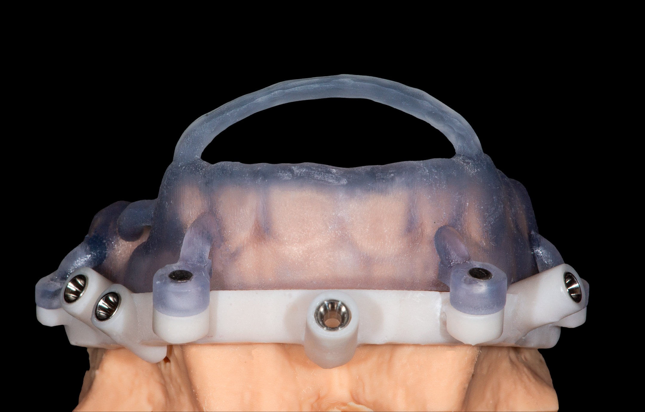 SGT Guides Stackable Surgical Guides Dental Implant Guided Surgery