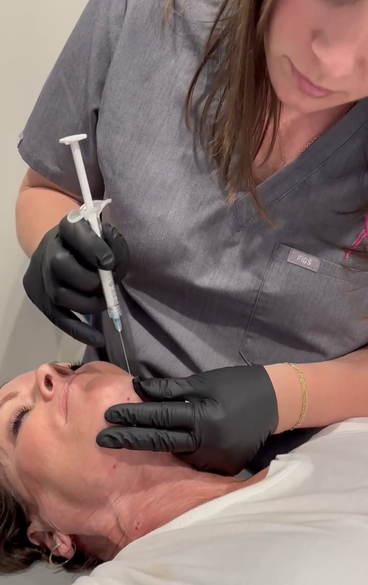 Radiesse+ Biostimulator: Instant & Long-Lasting Volume