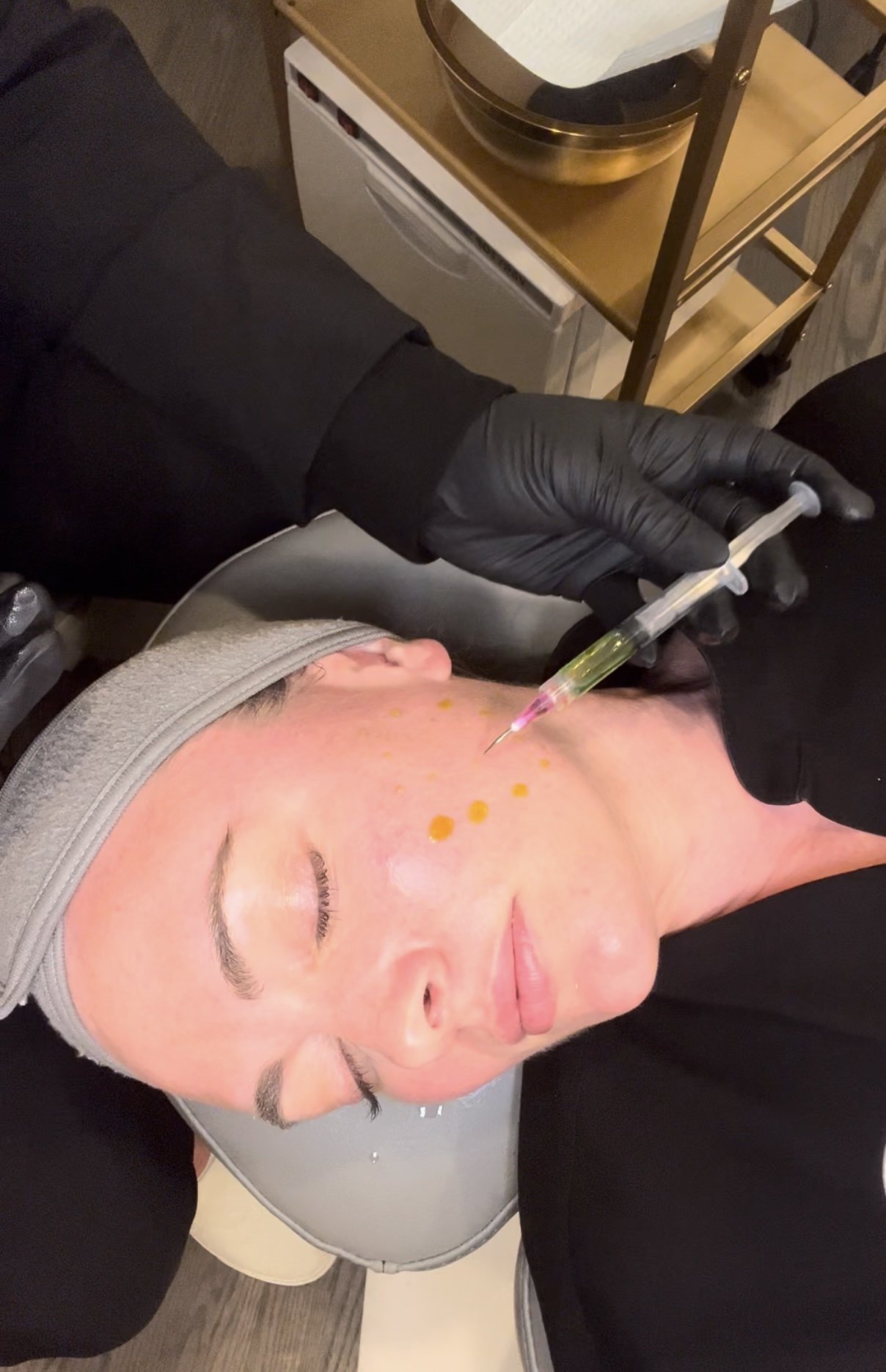 BioRePeel: The No-Peel Chemical Peel