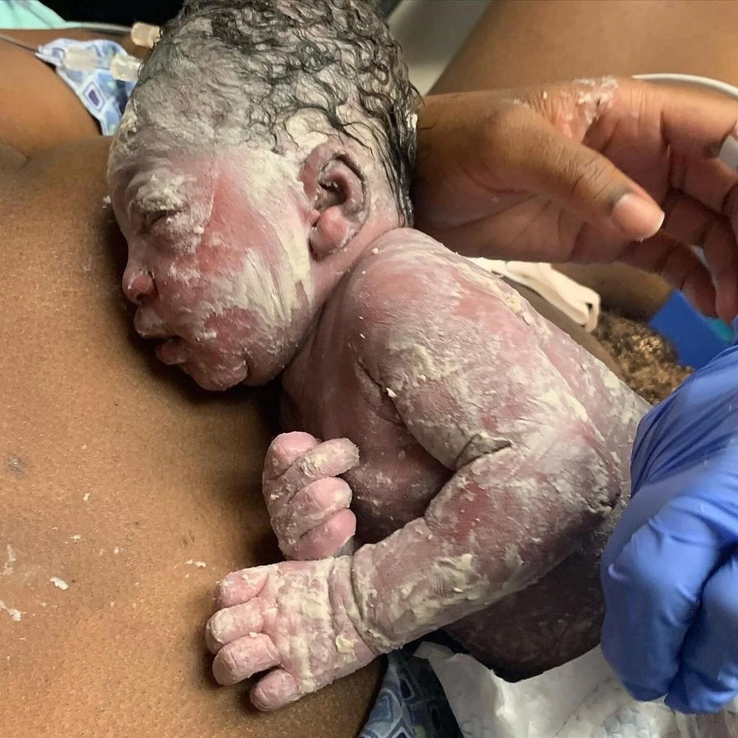 Ahhh, the miracle of vernix coating 😍! 
Team &ldquo;no bath&rdquo;over here 🙋🏽&zwj;♀️
Vernix acts as a super armor, full of protective qualities that absolutely help the baby&rsquo;s skin! 
Better than any lotion, coconut oil or Shea butter on the