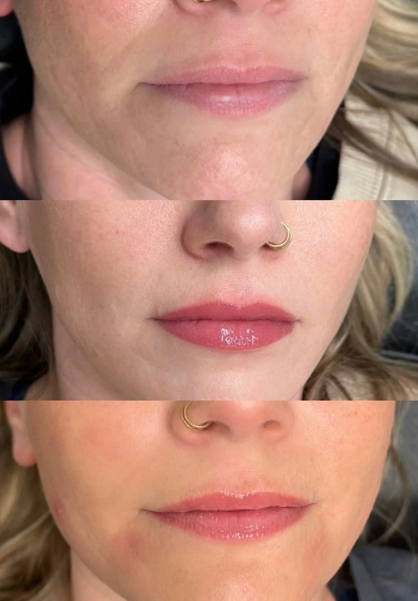 wisconsin lip blushsing showing beofre, after initial application, and healed results