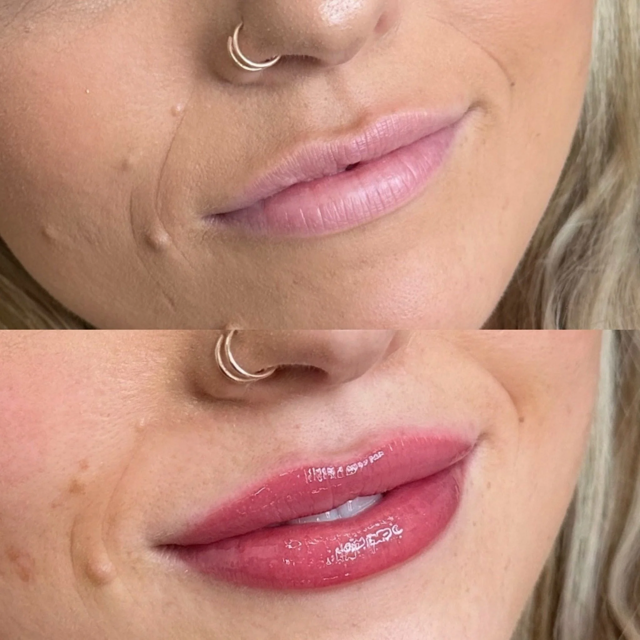 before and after showing how lip blushing evened out her lips and covered scars