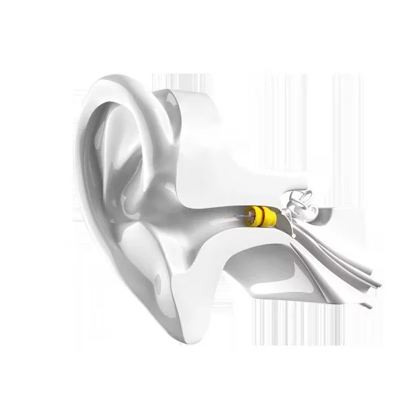 Invisible Hearing Aids vs. Traditional Hearing Aids: Which is Right for You?