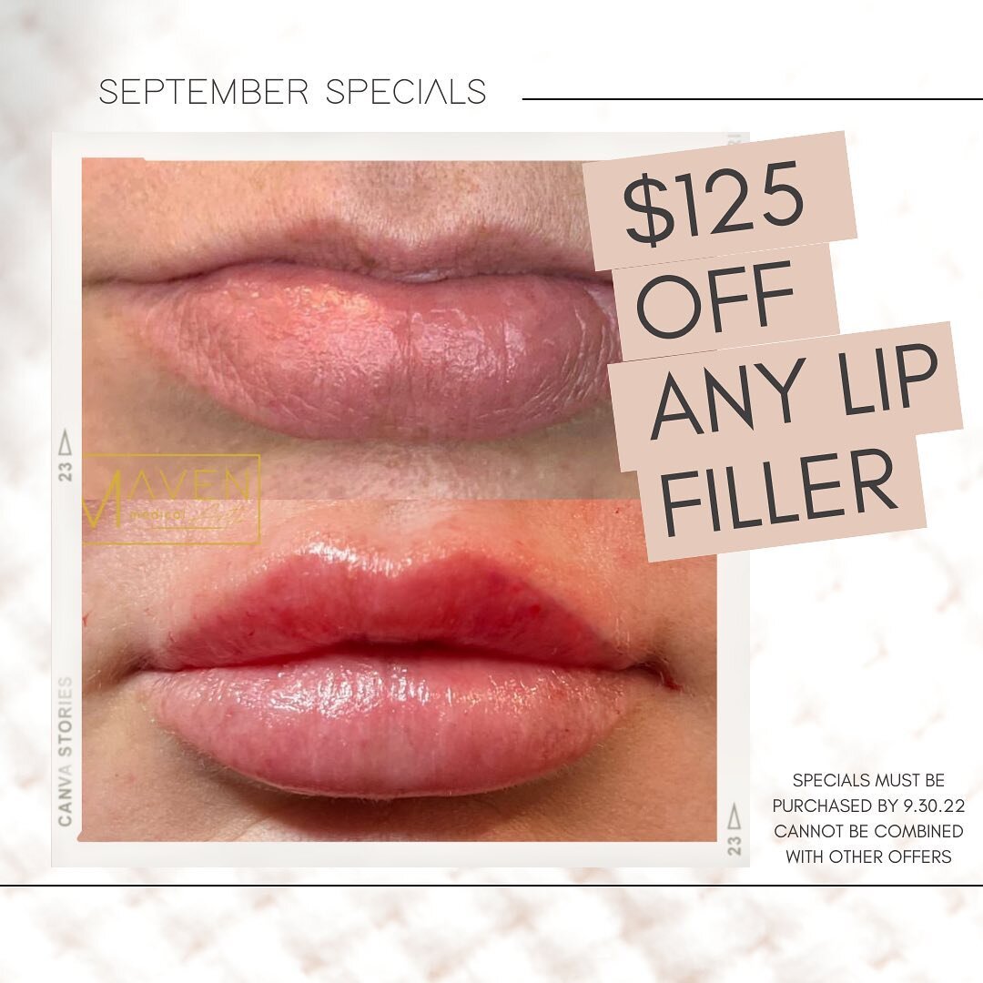 S E P T E M B E R 💋 S P E C I A L S
Visit us this month and take advantage of one of our amazing September specials:

&bull; Get $150 OFF any lip filler
&bull; FREE dermaplane with any facial service
&bull; Book botox with @injector.naomi and get $8