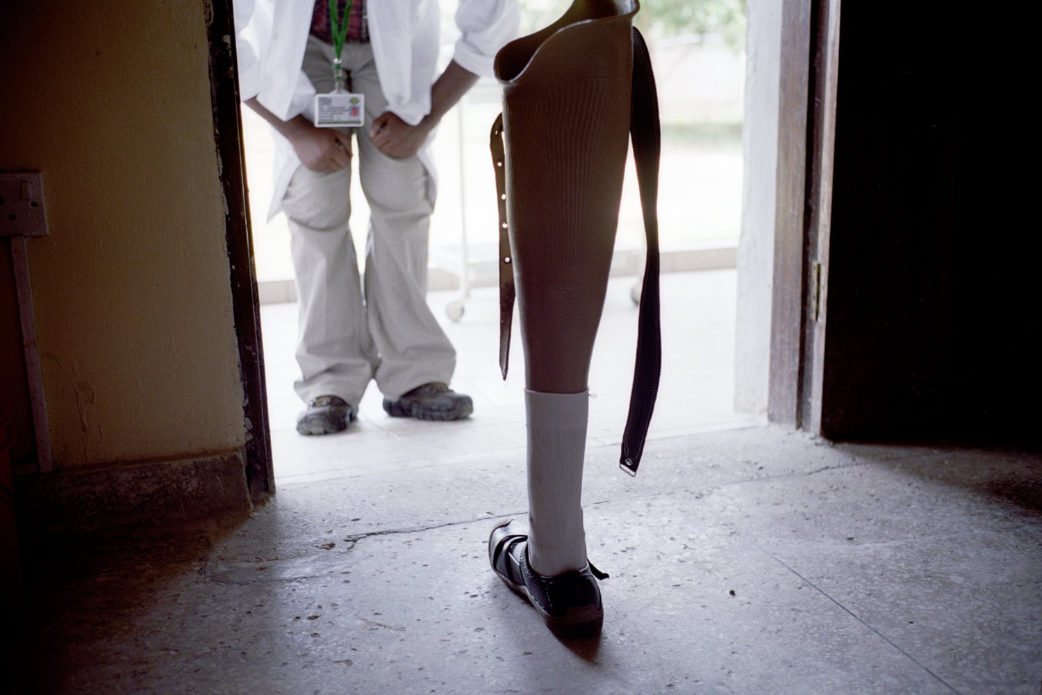 Dr Rashidi examines Bibiana Mbushi Mashamba's prosthetic leg at the CCBRT hospital, Dar es Salaam. Dar es Salaam, Tanzania.