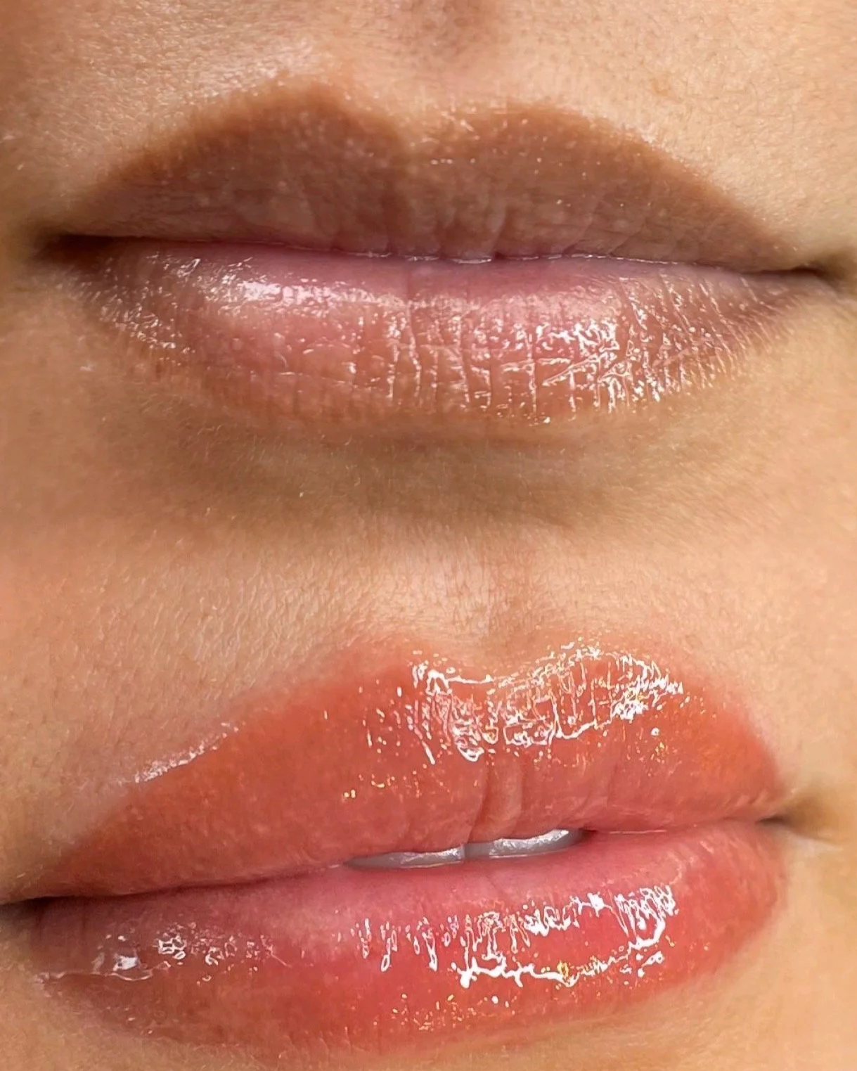 Lip Neutralization