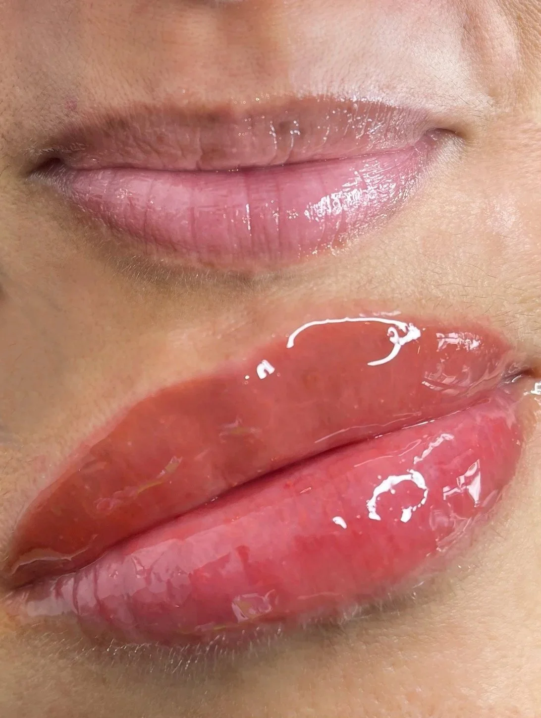 Lip Neutralization
