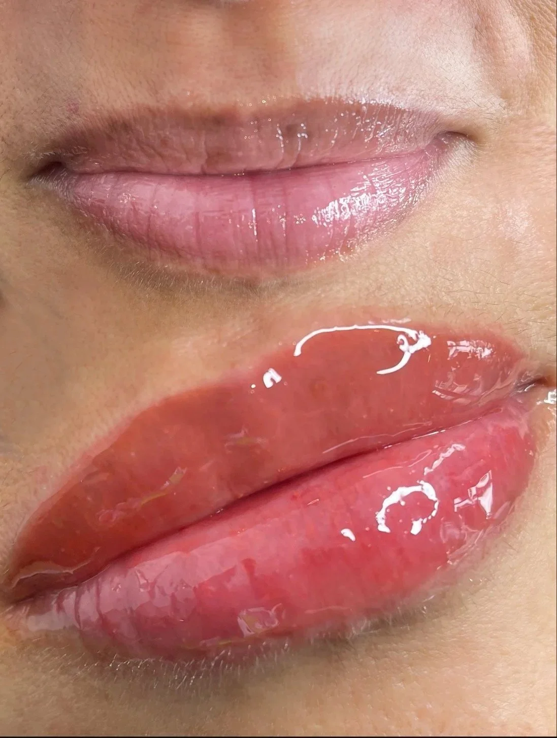 Lip Neutralization