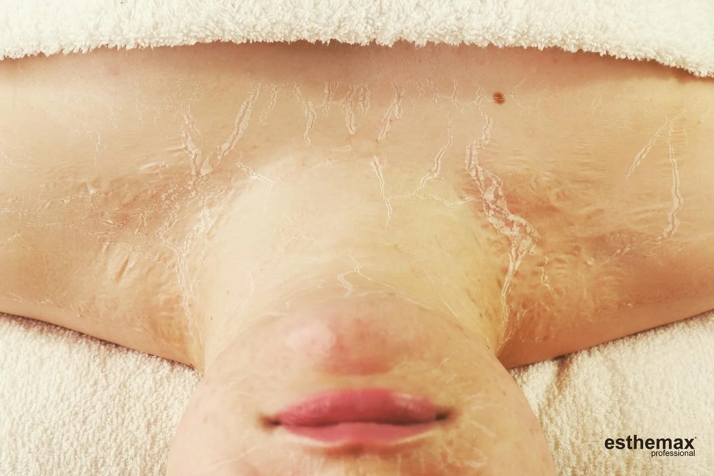 NEW DIVINE CONTOUR FACIAL..
What make this facial so amazing??

✨ARGIRELINE✨
Argireline is known to target fine lines and subtle expression wrinkles (caused by repeated muscle movement)
It is a non-toxic peptide that affects the nerve-to muscle commu