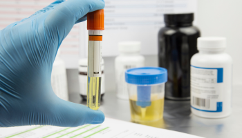 5 drug and alcohol testing misconceptions