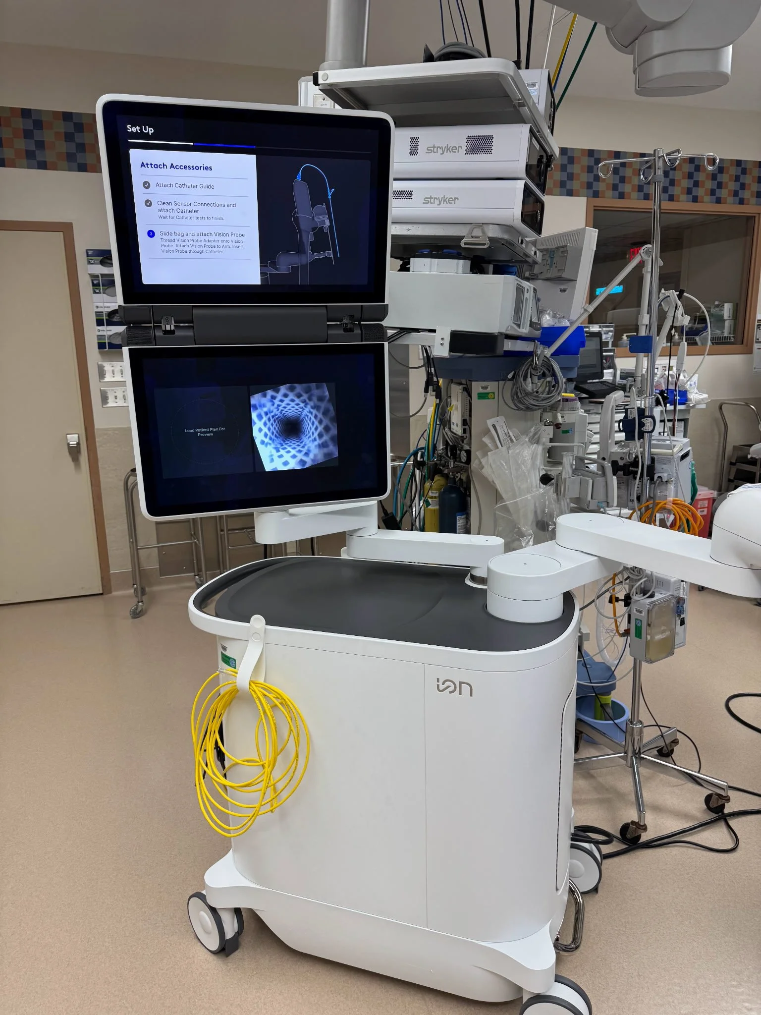 UnityPoint Health – Trinity Achieves Milestone With 100th Robotic Lung Biopsy