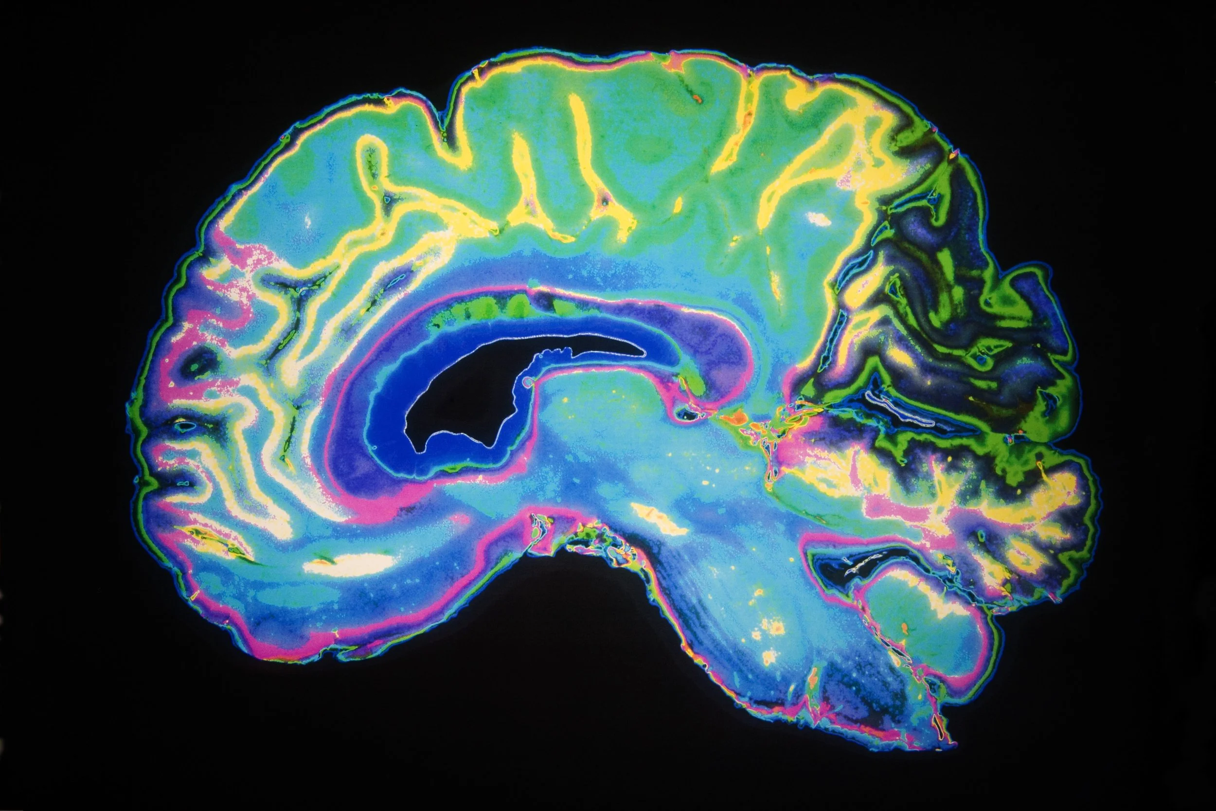 New Oasis Classes on Dementia Prevention Start 9/2/26