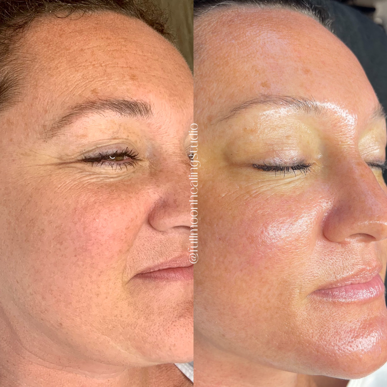 Facial Treatments  + Skincare