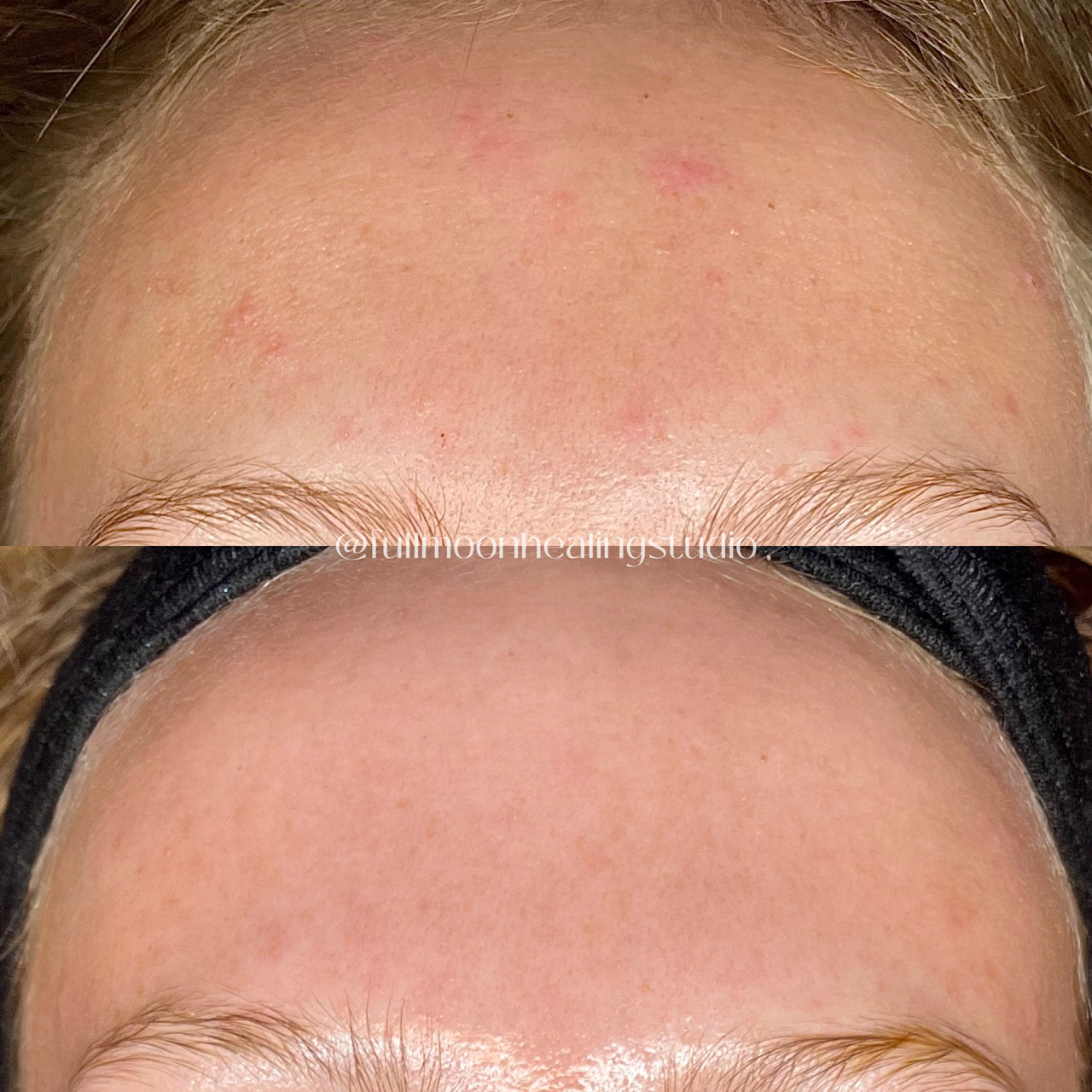 Results from Facial Treatments + Skincare