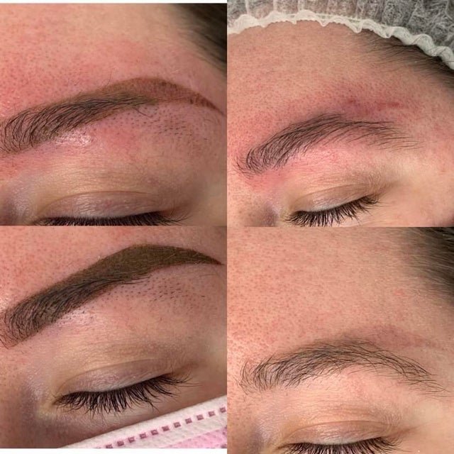 Microblading removal. 99 — FoxLux Beauty