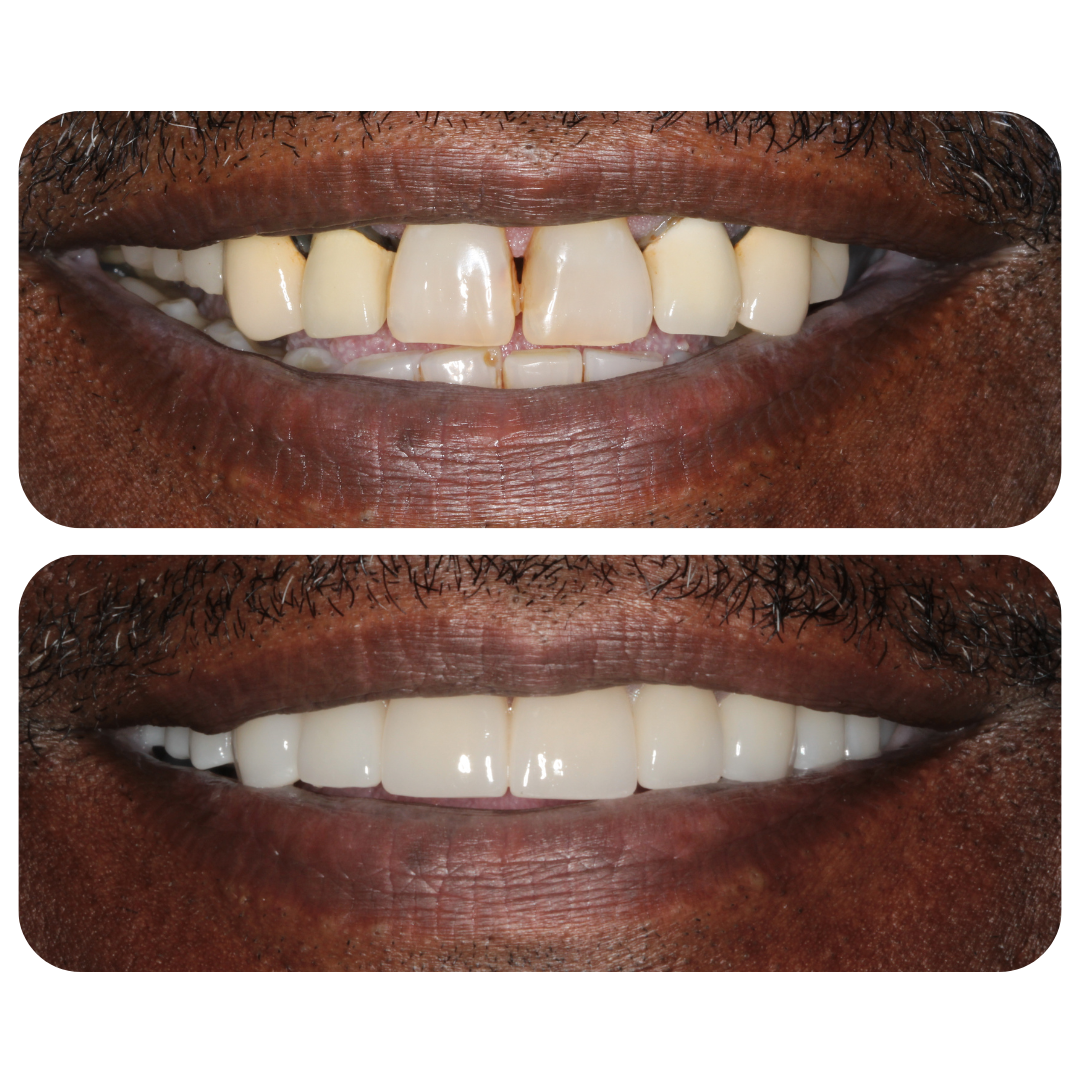 Untitled design (4).png