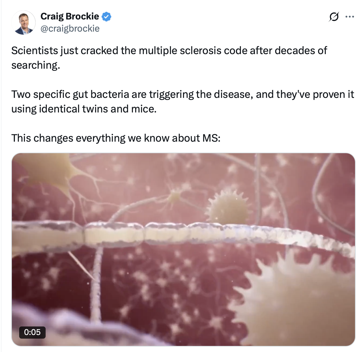 Scientists discover two gut bacteria ‘triggering’ MS!