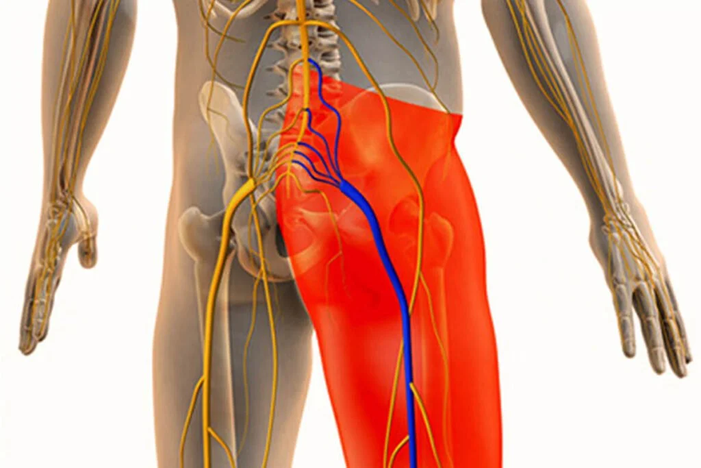 Sciatica and Herniated Discs: What's the Difference?