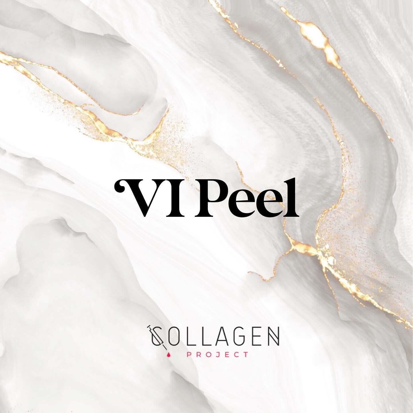 ViPeel

When you think of Collagen Project, chances are you think of it as the best place for Morpheus8 and Exosomes in South Florida. But did you know we also offer VI Peel Treatments at Collagen Project in Miami Beach. Collagen Project is, after al