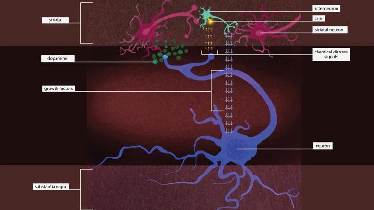 Inhibiting enzyme could halt cell death in Parkinson's disease