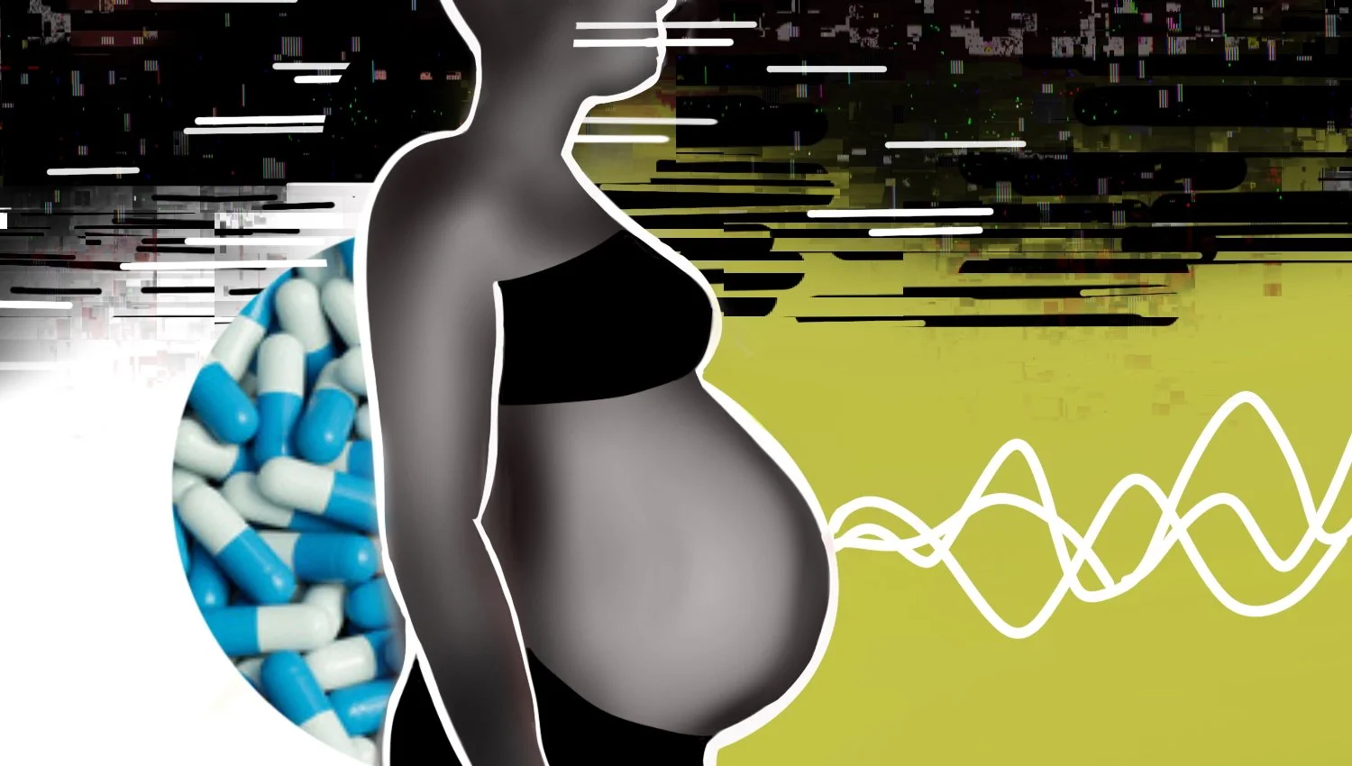 A Stanford Medicine-led study found that two common medications for epilepsy offer a safe alternative to older antiseizure medications that are known to be harmful to fetuses. Credit: Emily Moskal/Stanford Medicine
